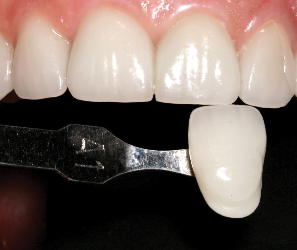 Finding a Dentist with an Effective Checklist