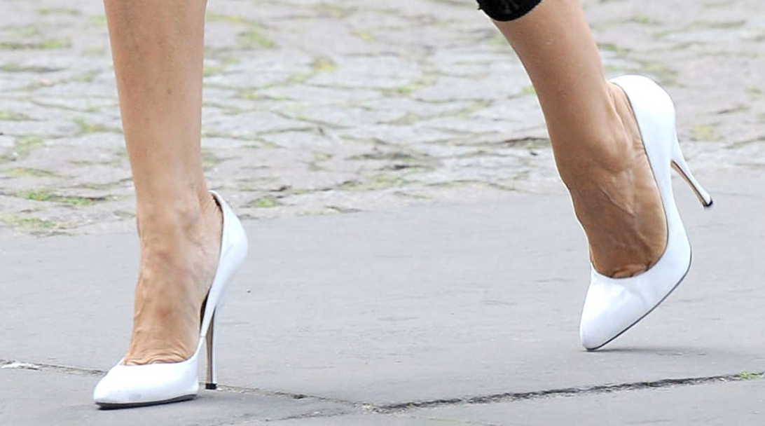 An Overview Of Varicose Veins