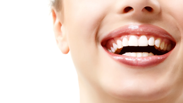 Useful Techniques Of Teeth Whitening South In Yarra