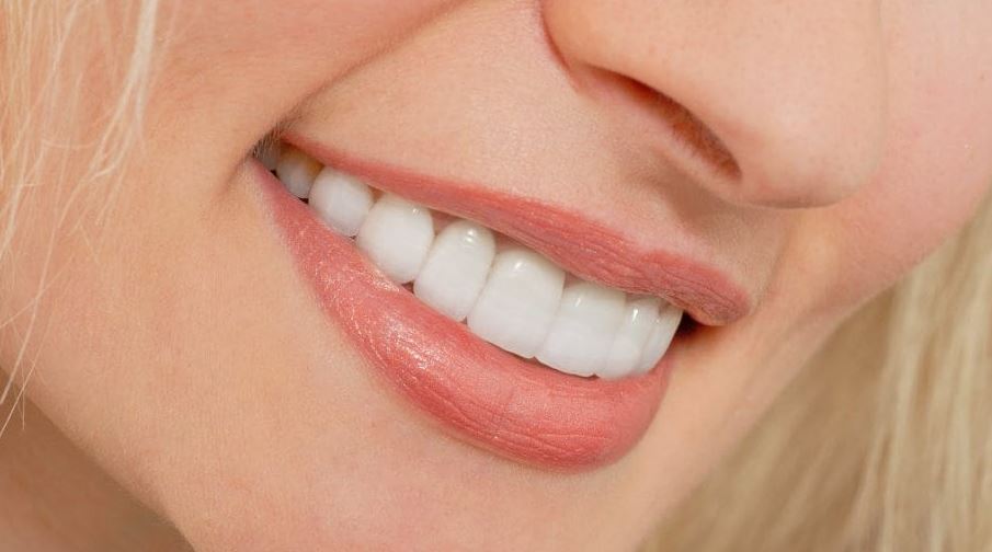 Get your smile back with teeth veneers gold coast