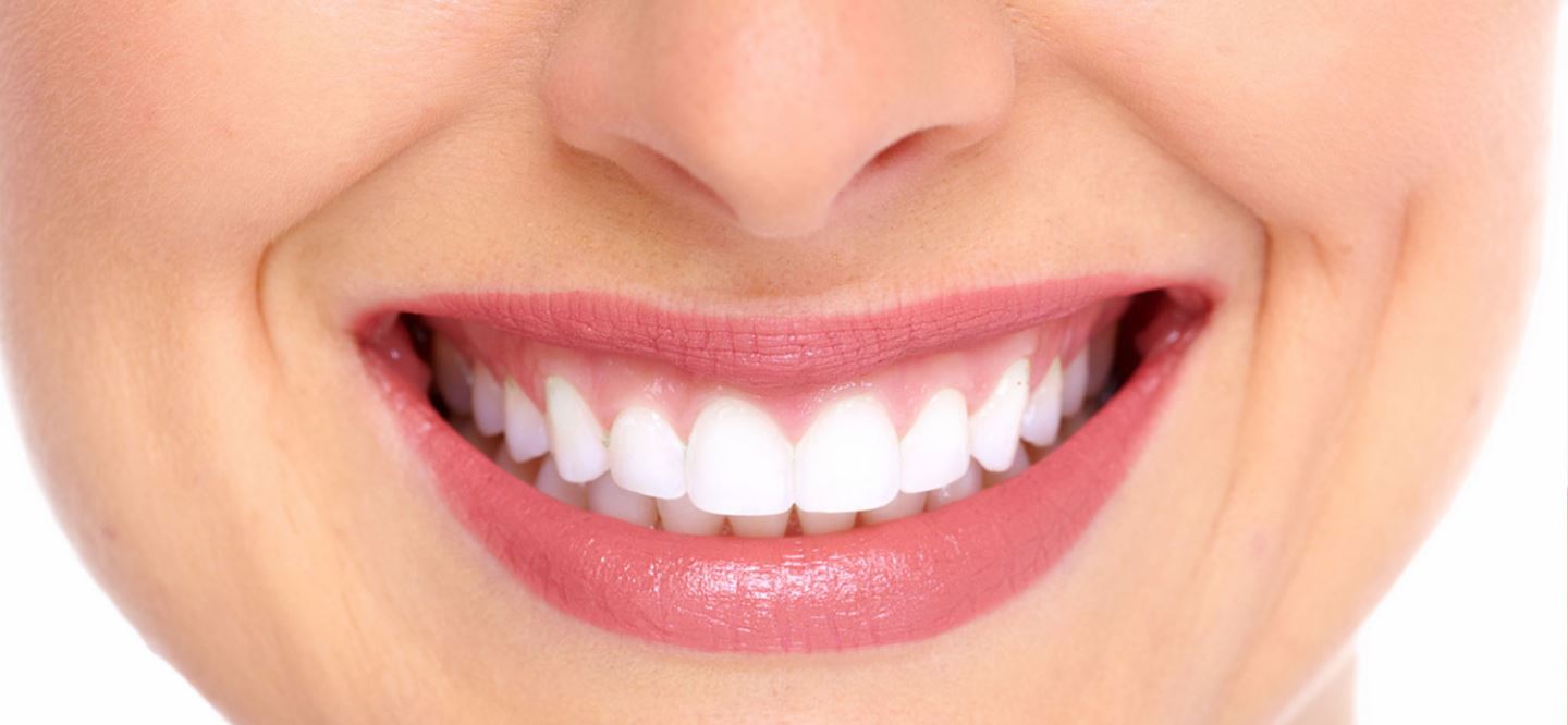 Get teeth veneers Gold Coast from professional dentists