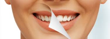 Questions to Ask Your Cosmetic Dentist