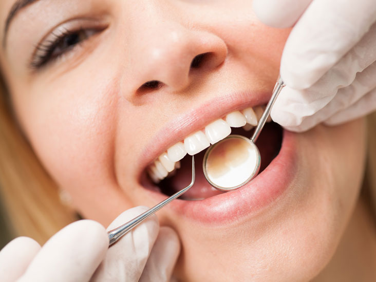 What Exactly Professional Dental Cleanings Can Give You