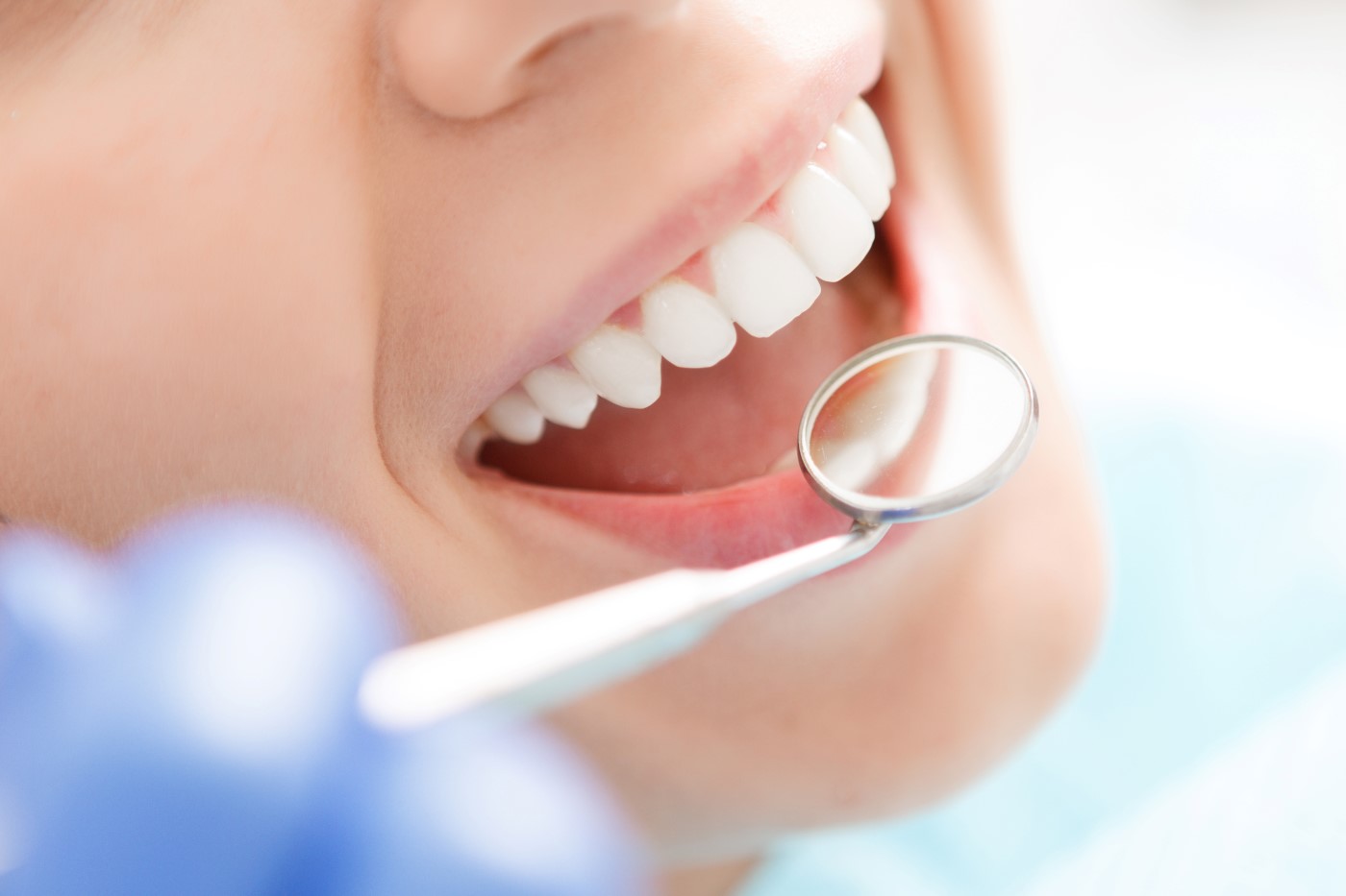 Fixing The Most Suitable Dental Crowns In Gold Coast