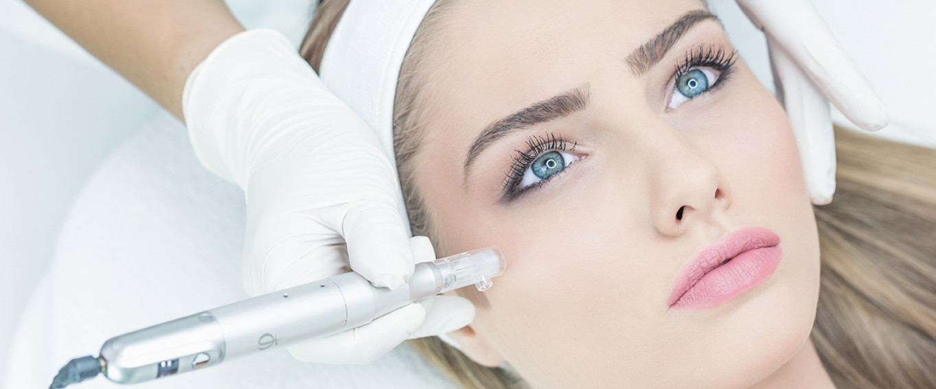 Skin needling treatment