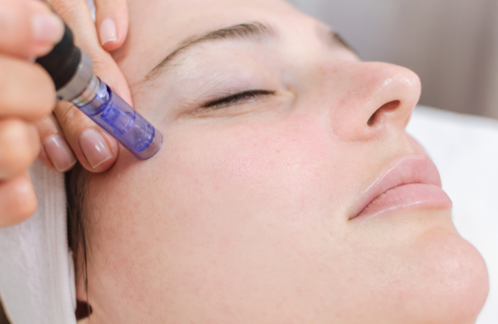 Skin needling treatment