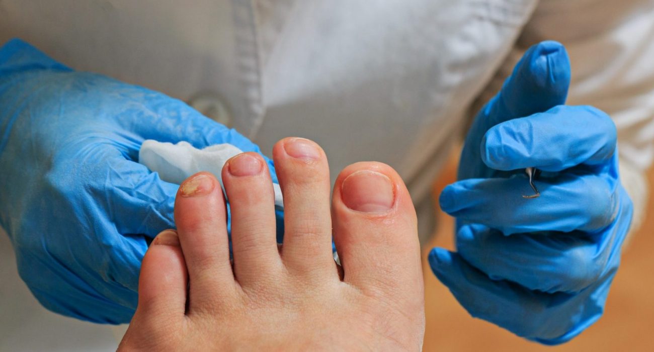 What Podiatry Paddington Services Talk About Foot Care