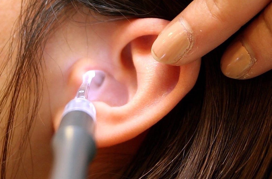 Finding ENT Specialists for Aural Toilet Brisbane