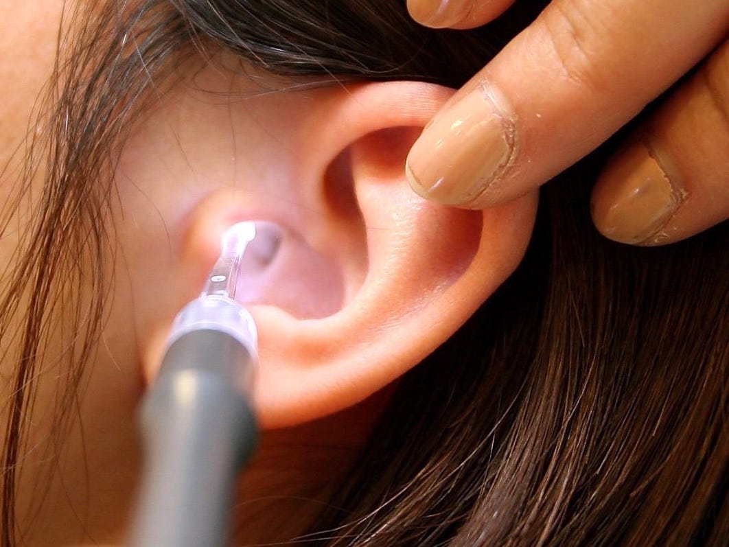 vacuum ear wax