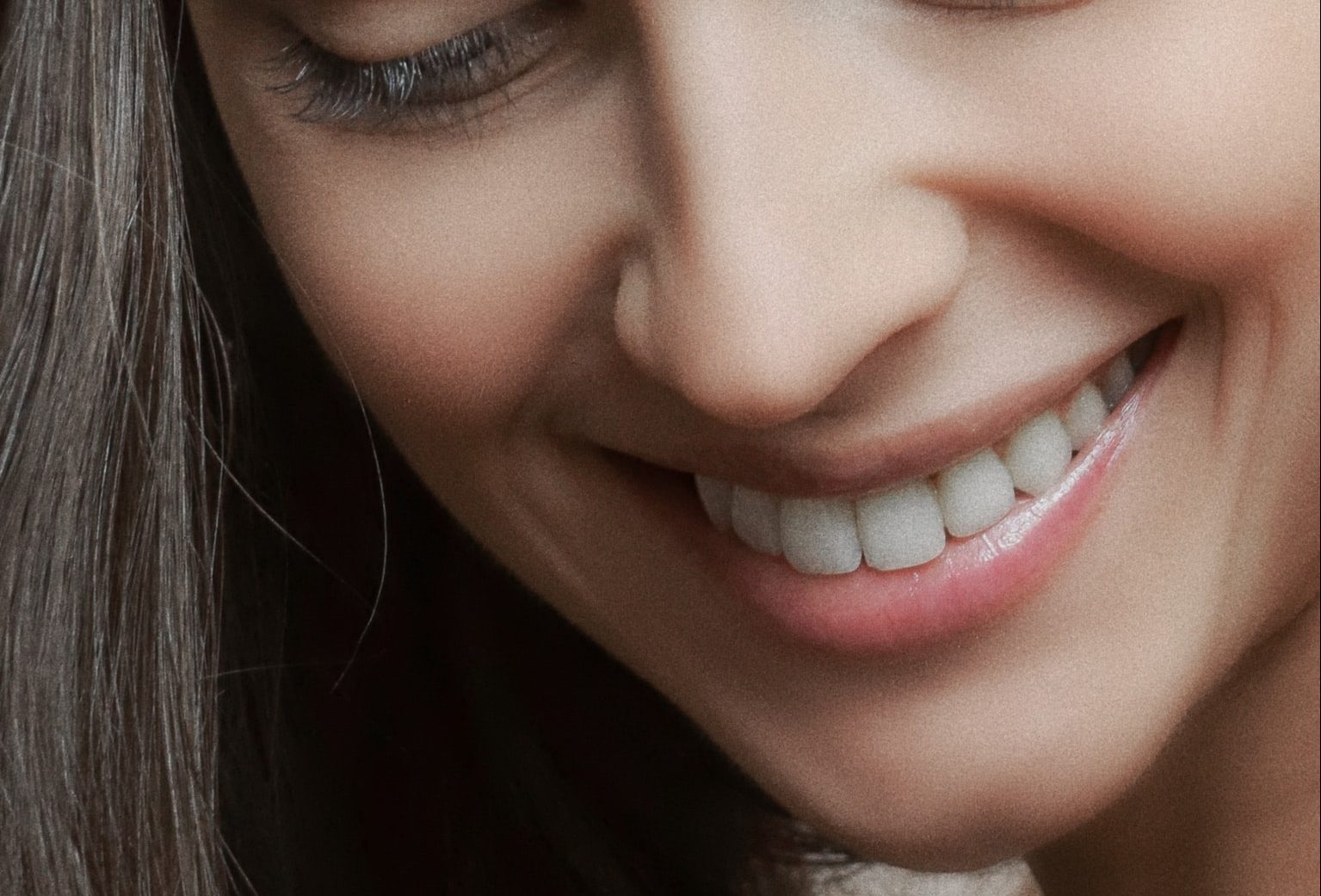 dental crowns in Gold Coast