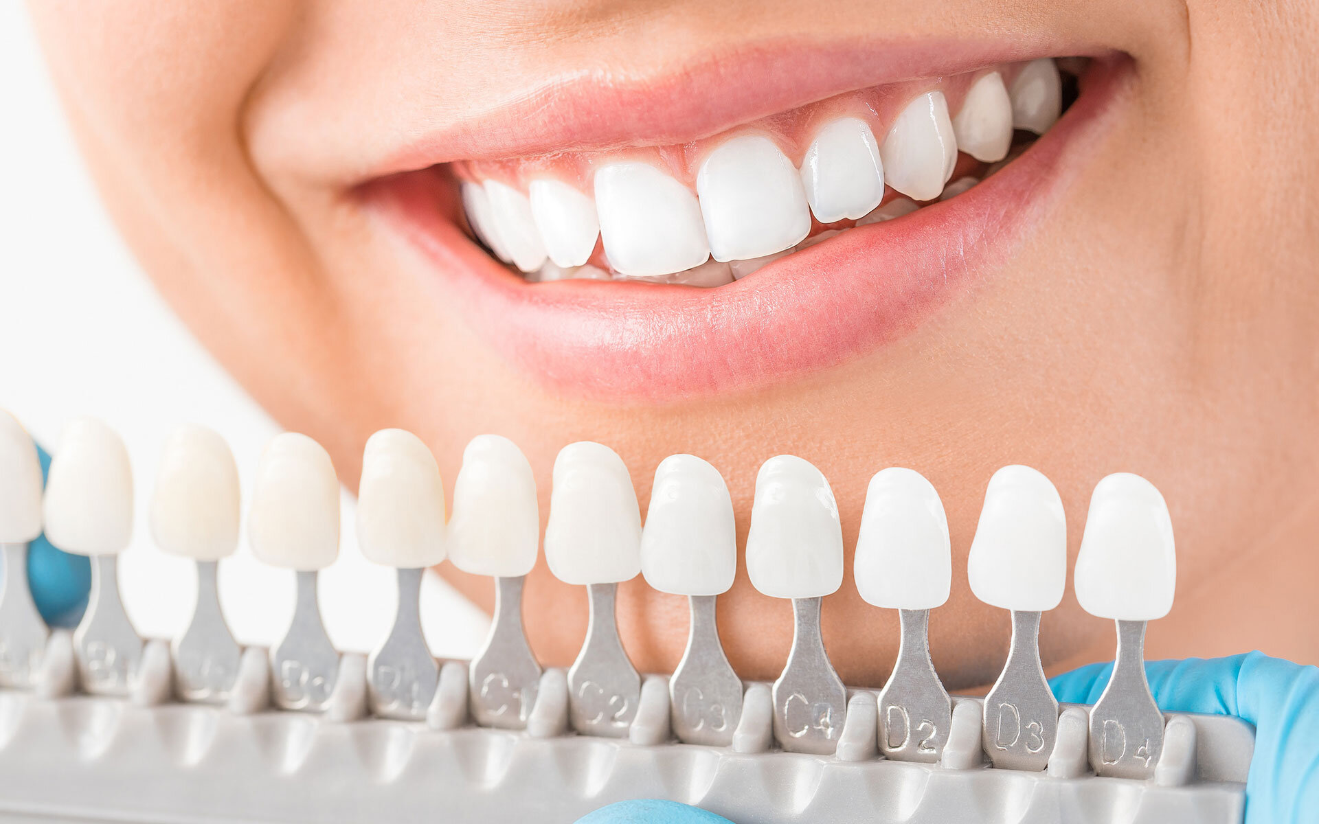 dental implants in Northern Rivers