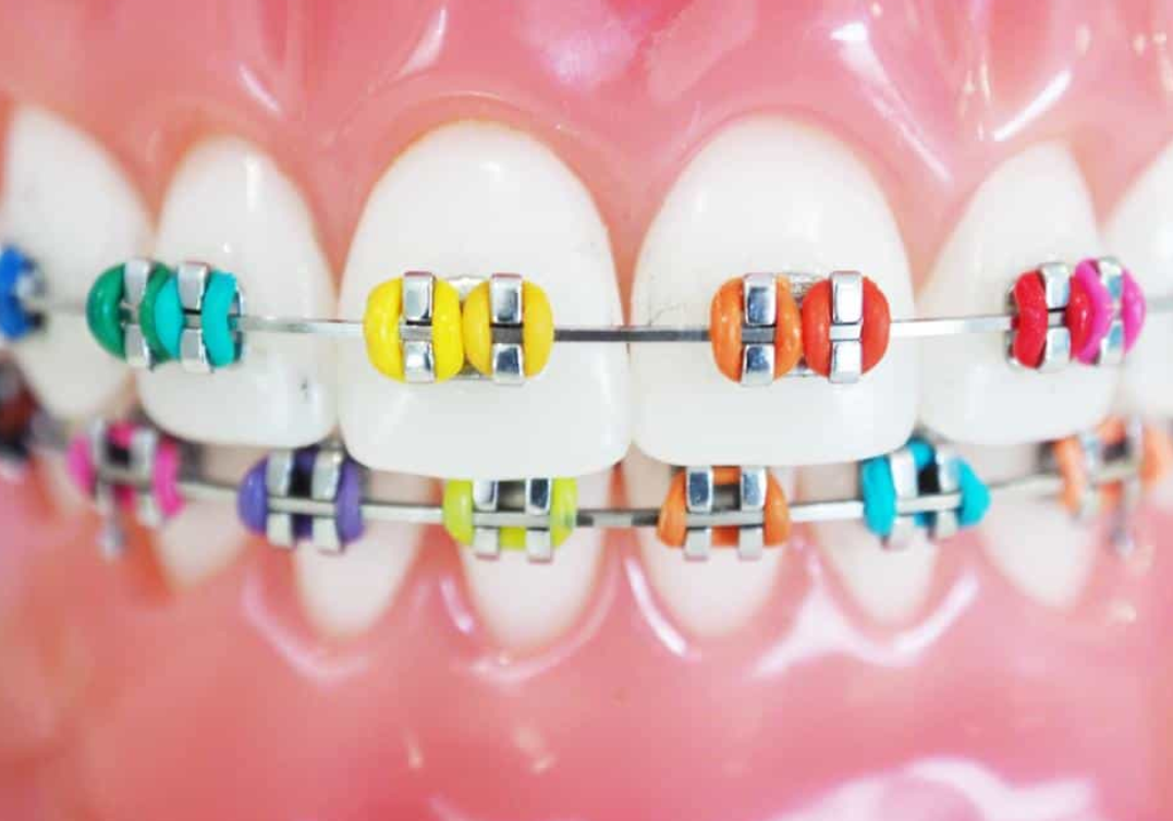 orthodontics services