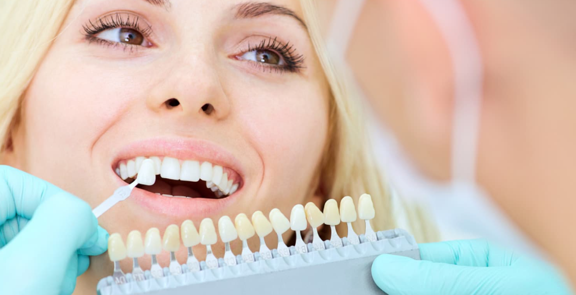 Kit Whitening Teeth – What You Should Know