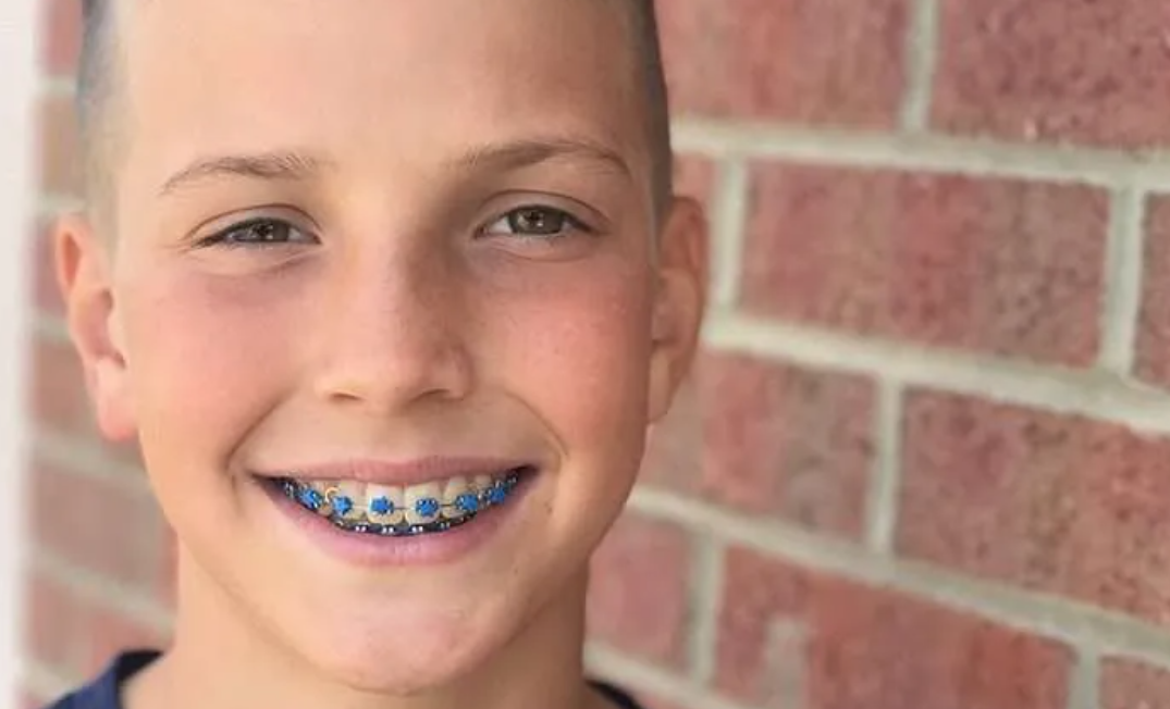 orthodontic treatment in Victoria