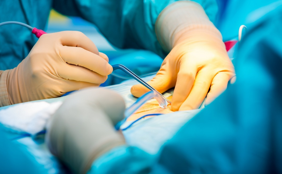 How Electrosurgical Instruments Have Revolutionized the Field of Surgery: