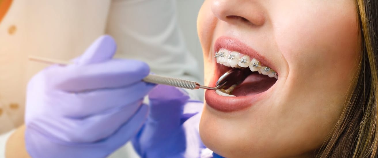 orthodontic treatment