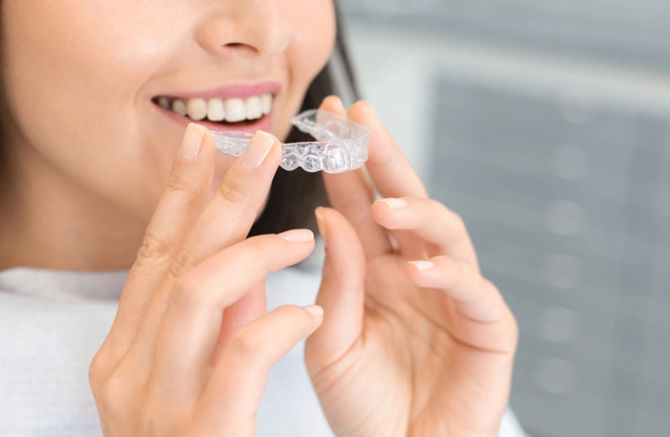 Invisalign Treatment In Victoria