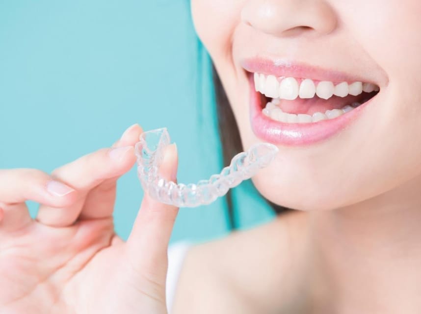 Invisalign Treatment In Victoria