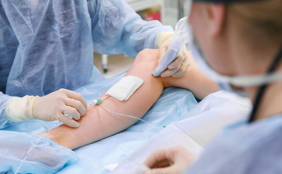 endovenous thermal ablation