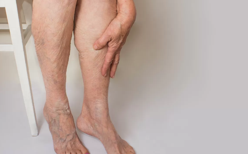 Endovenous thermal ablation