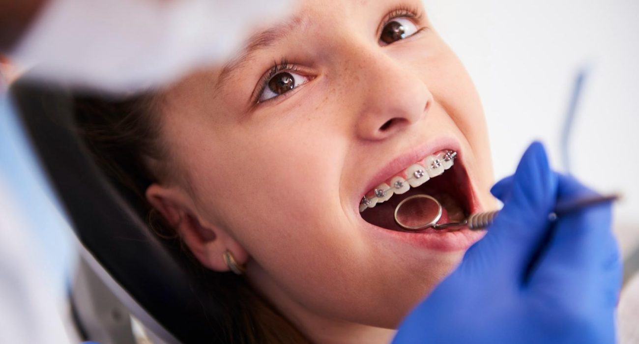 Symptoms to Note That You Need Orthodontics Services